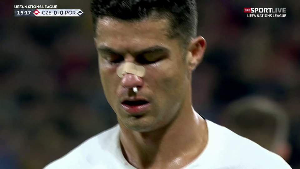 Ronaldo stösst mit Vaclik zusammen und blutet heftig