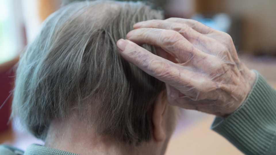 Alzheimer-Studie sorgt für Aufregung