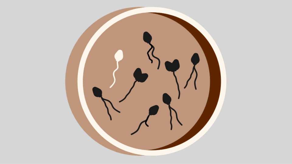 Schlappe Spermien – Männliche Fruchtbarkeit in der Krise