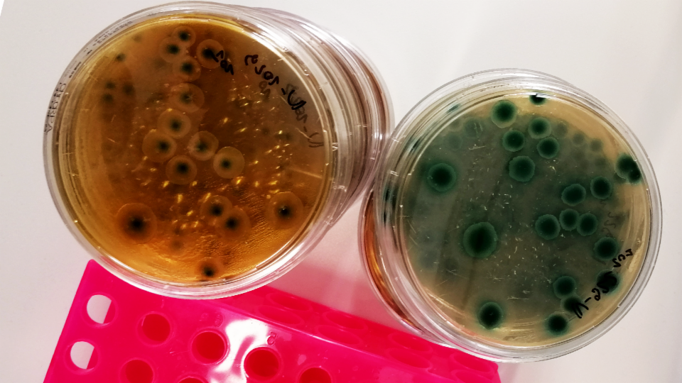 Wie ein Speziallabor antiobiotikaresistente Bakterien angeht