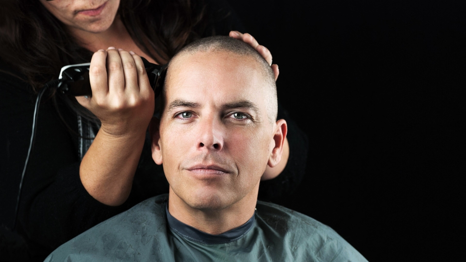 Mut zur Glatze – statt Haare um jeden Preis