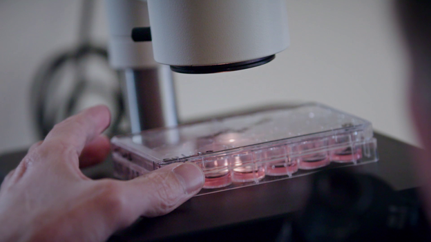 Archiv: Mini-Organe aus Stammzellen