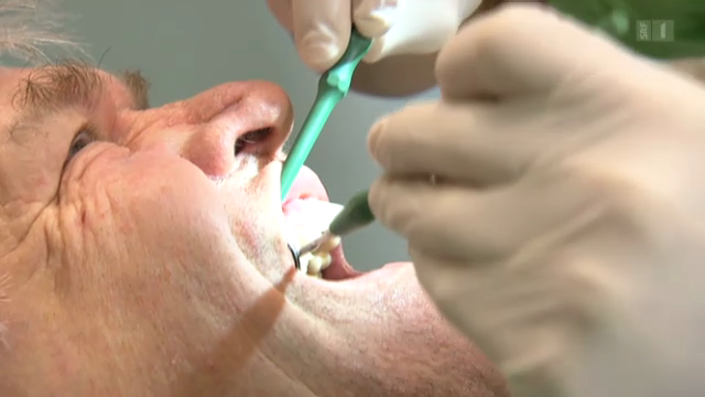 Freiliegende Zahnhälse - Falsches Zähneputzen als Ursache