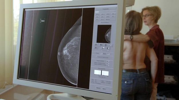 Brustkrebsdiagnostik – Genauere Resultate dank neuen Technologien